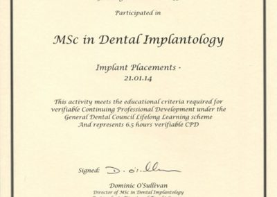 Implant Placements 21 Jan 2014