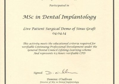 Live Patient Surgical Demo of Sinus Graft April 2014